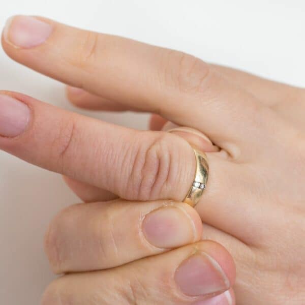 How to Get A Ring Off A Swollen Finger